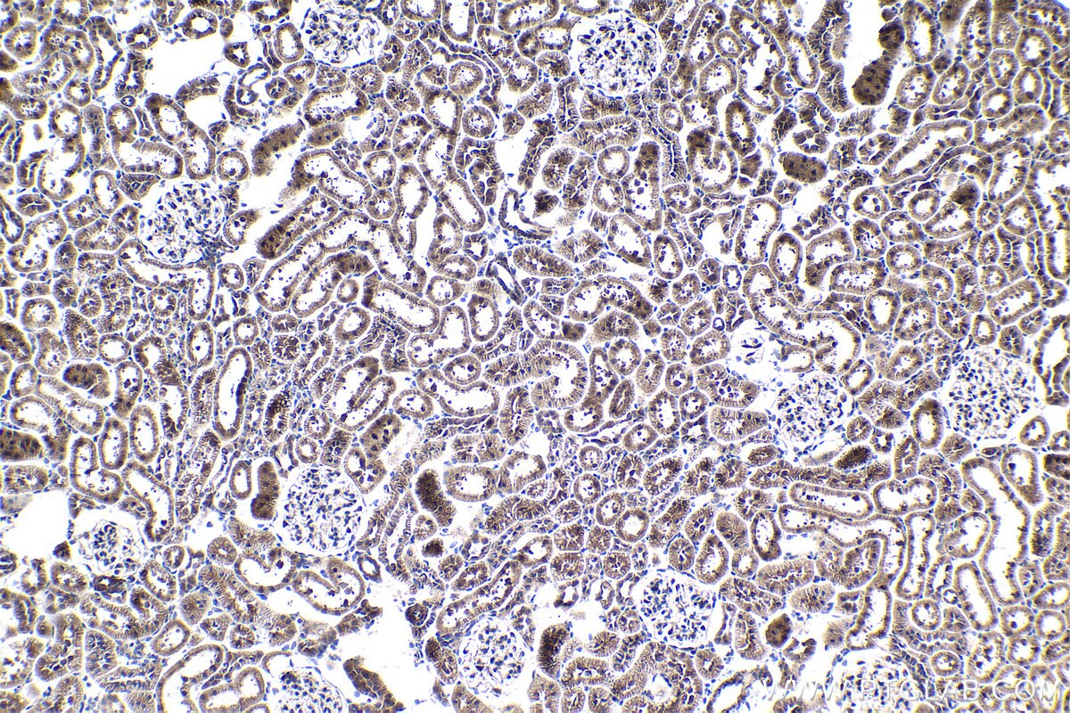 Immunohistochemistry (IHC) staining of rat kidney tissue using ELP2 Polyclonal antibody (13793-1-AP)