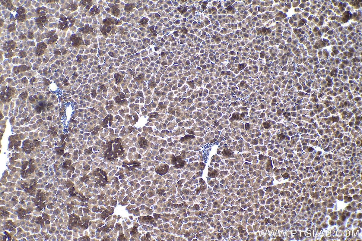 Immunohistochemistry (IHC) staining of rat liver tissue using ELP2 Polyclonal antibody (13793-1-AP)