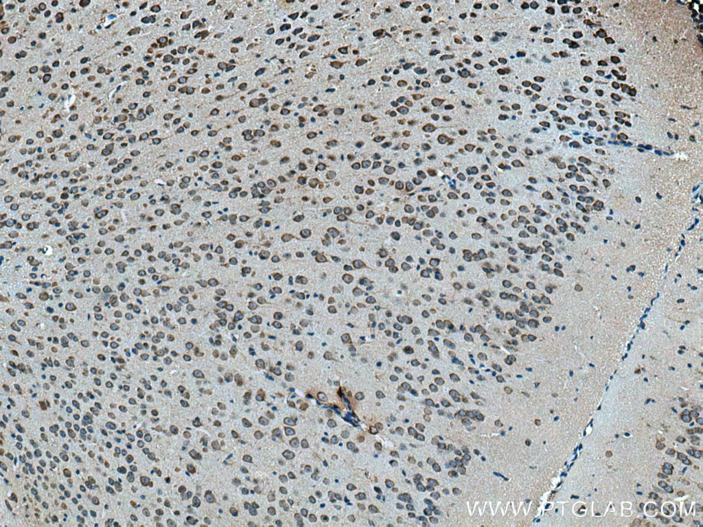 Immunohistochemistry (IHC) staining of mouse brain tissue using ELP3 Polyclonal antibody (17016-1-AP)