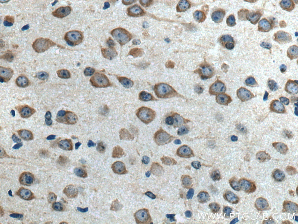 Immunohistochemistry (IHC) staining of mouse brain tissue using ELP3 Polyclonal antibody (17016-1-AP)