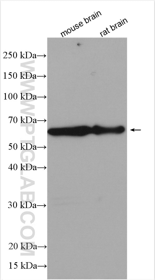 Western Blot (WB) analysis of various lysates using ELP3 Polyclonal antibody (17016-1-AP)