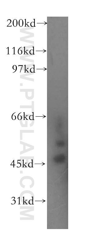 Western Blot (WB) analysis of human brain tissue using ELP4 Polyclonal antibody (12746-1-AP)