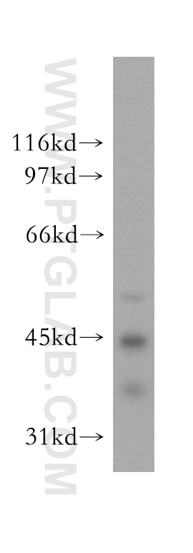 Western Blot (WB) analysis of human cerebellum tissue using ELP4 Polyclonal antibody (12746-1-AP)