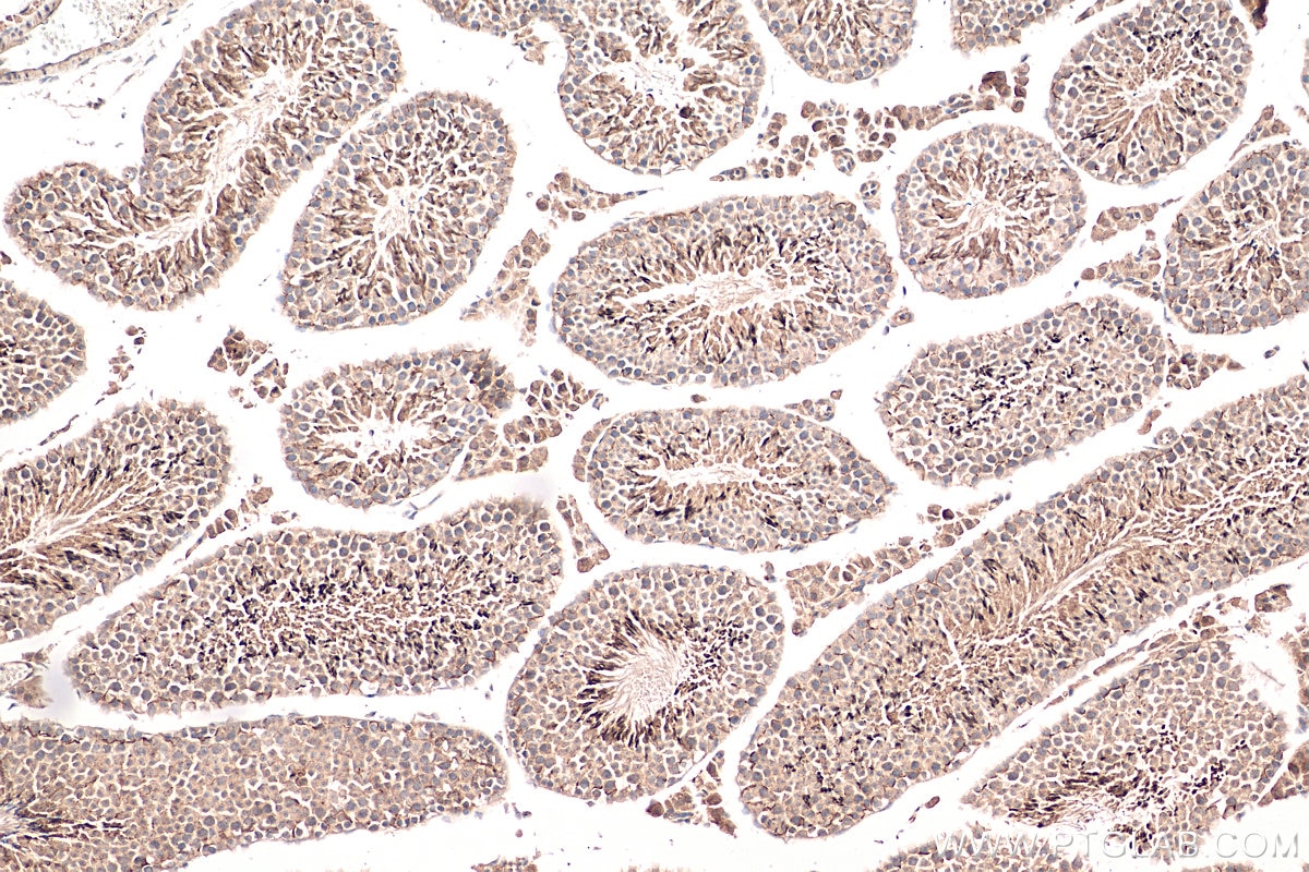 IHC staining of mouse testis using 13946-1-AP