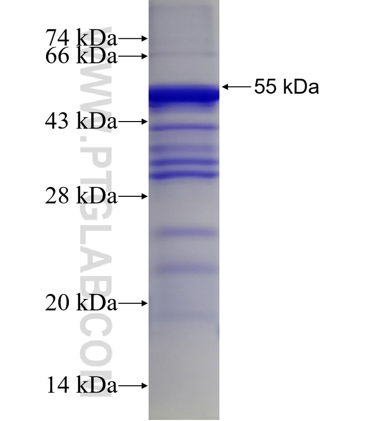 EMB fusion protein Ag5031 SDS-PAGE