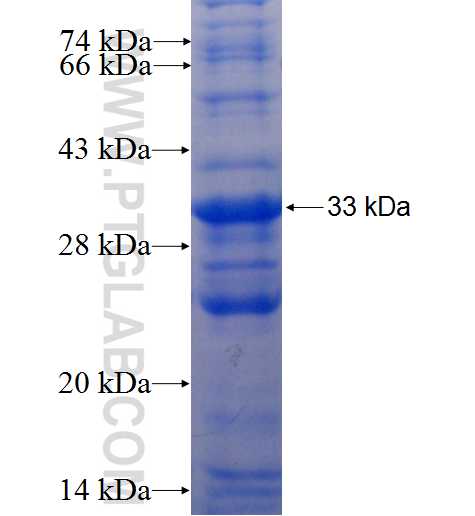EMB fusion protein Ag5382 SDS-PAGE EMB fusion protein Ag5382 SDS-PAGE