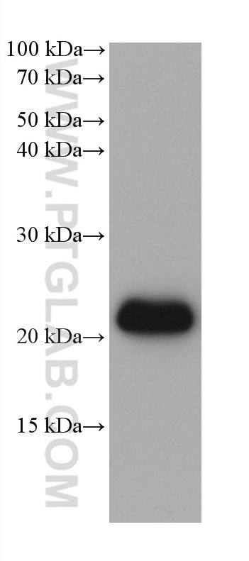 WB analysis using 68722-1-Ig