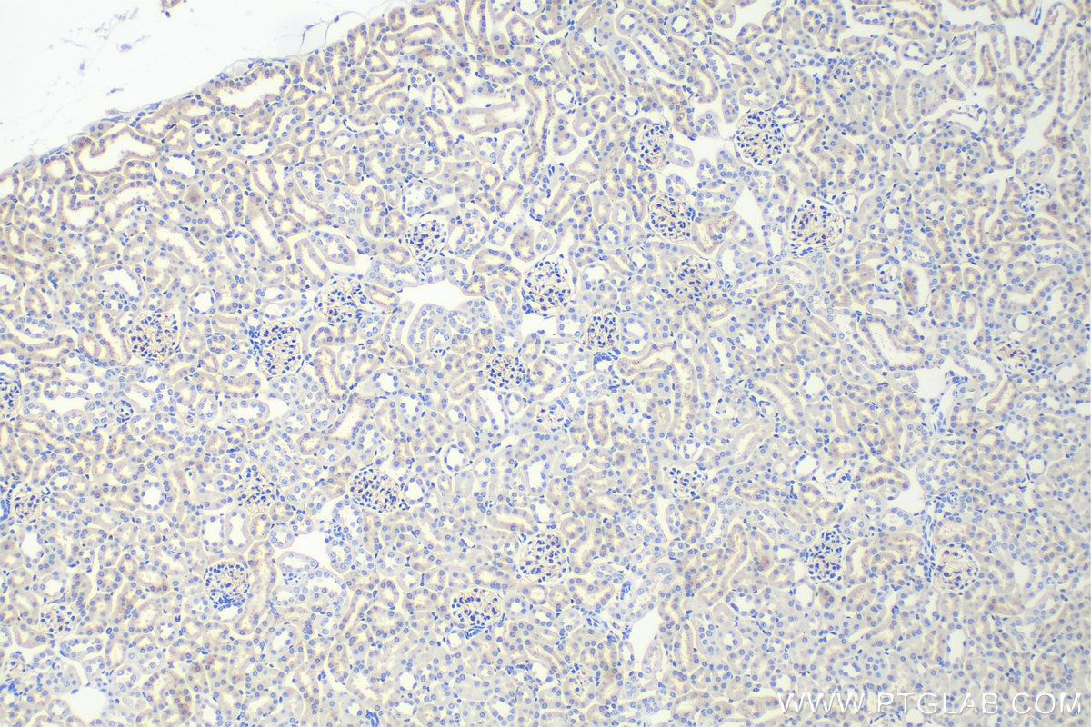 Immunohistochemistry (IHC) staining of mouse kidney tissue using EMCN Polyclonal antibody (11828-1-AP)