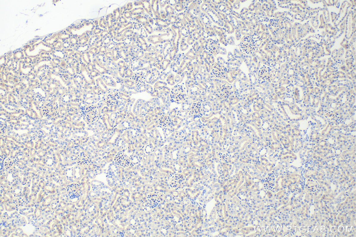 Immunohistochemistry (IHC) staining of mouse kidney tissue using EMCN Polyclonal antibody (11828-1-AP)