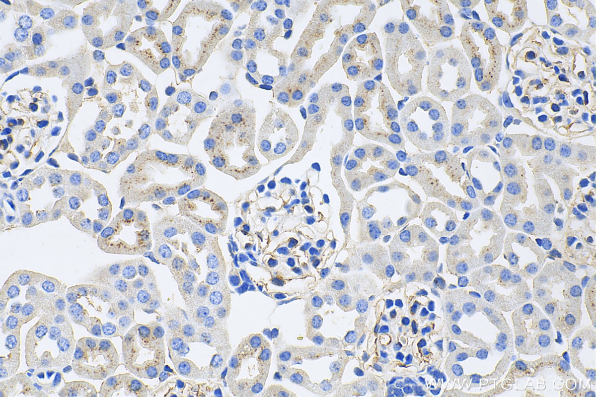 IHC staining of mouse kidney using 11828-1-AP