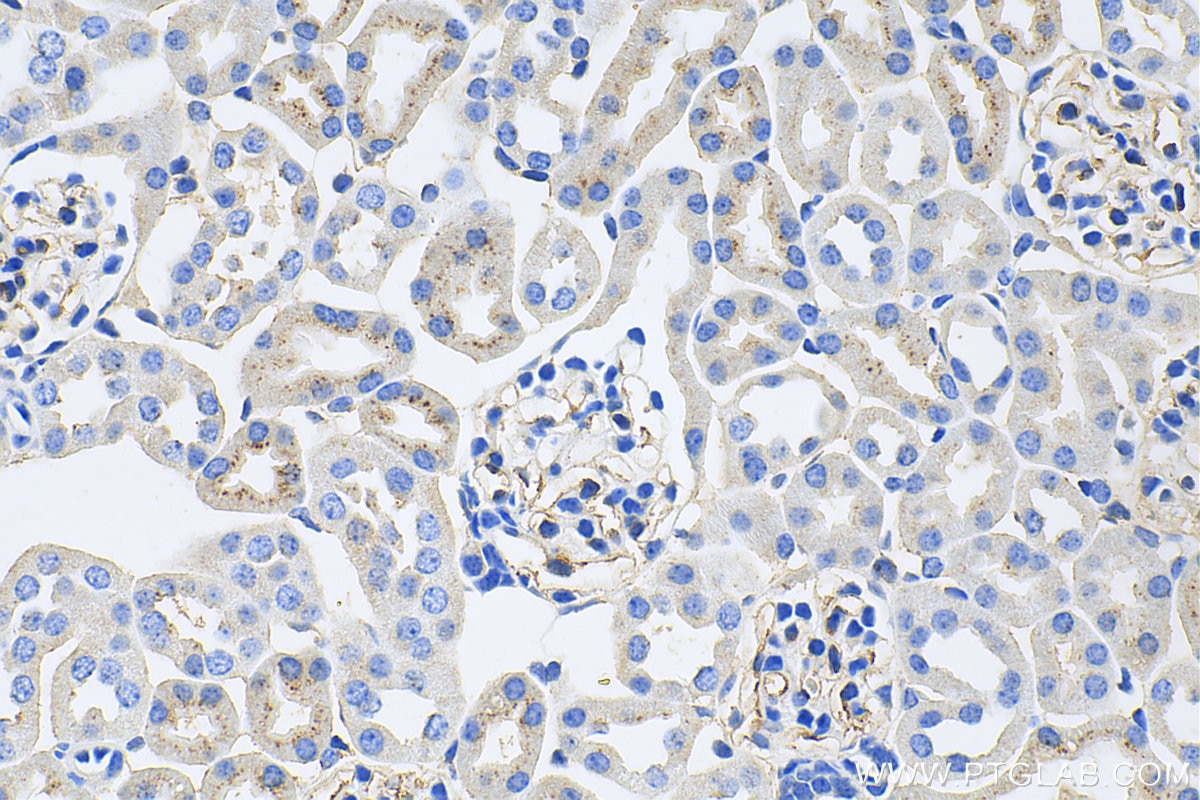 Immunohistochemistry (IHC) staining of mouse kidney tissue using EMCN Polyclonal antibody (11828-1-AP)