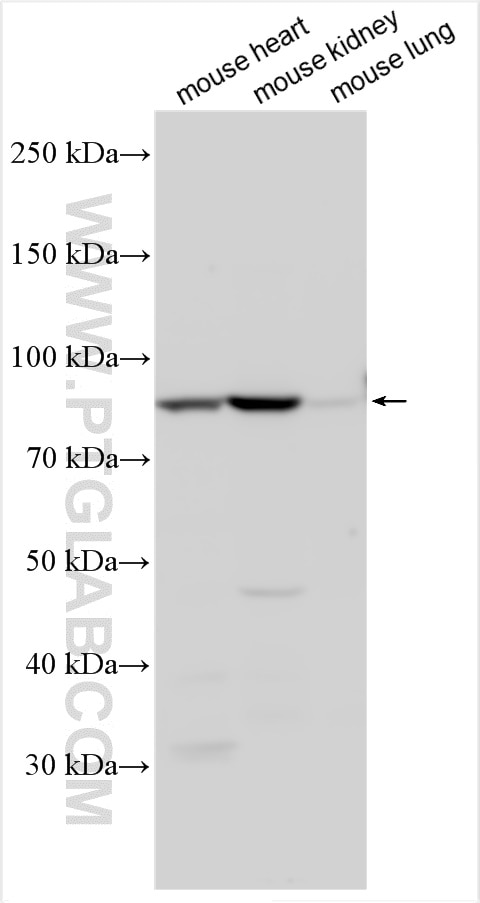 Western Blot (WB) analysis of various lysates using EMCN Polyclonal antibody (11828-1-AP)
