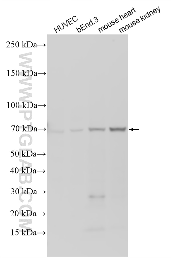 WB analysis using 11828-1-AP Western Blot (WB) analysis of various lysates using EMCN Polyclonal antibody (11828-1-AP)