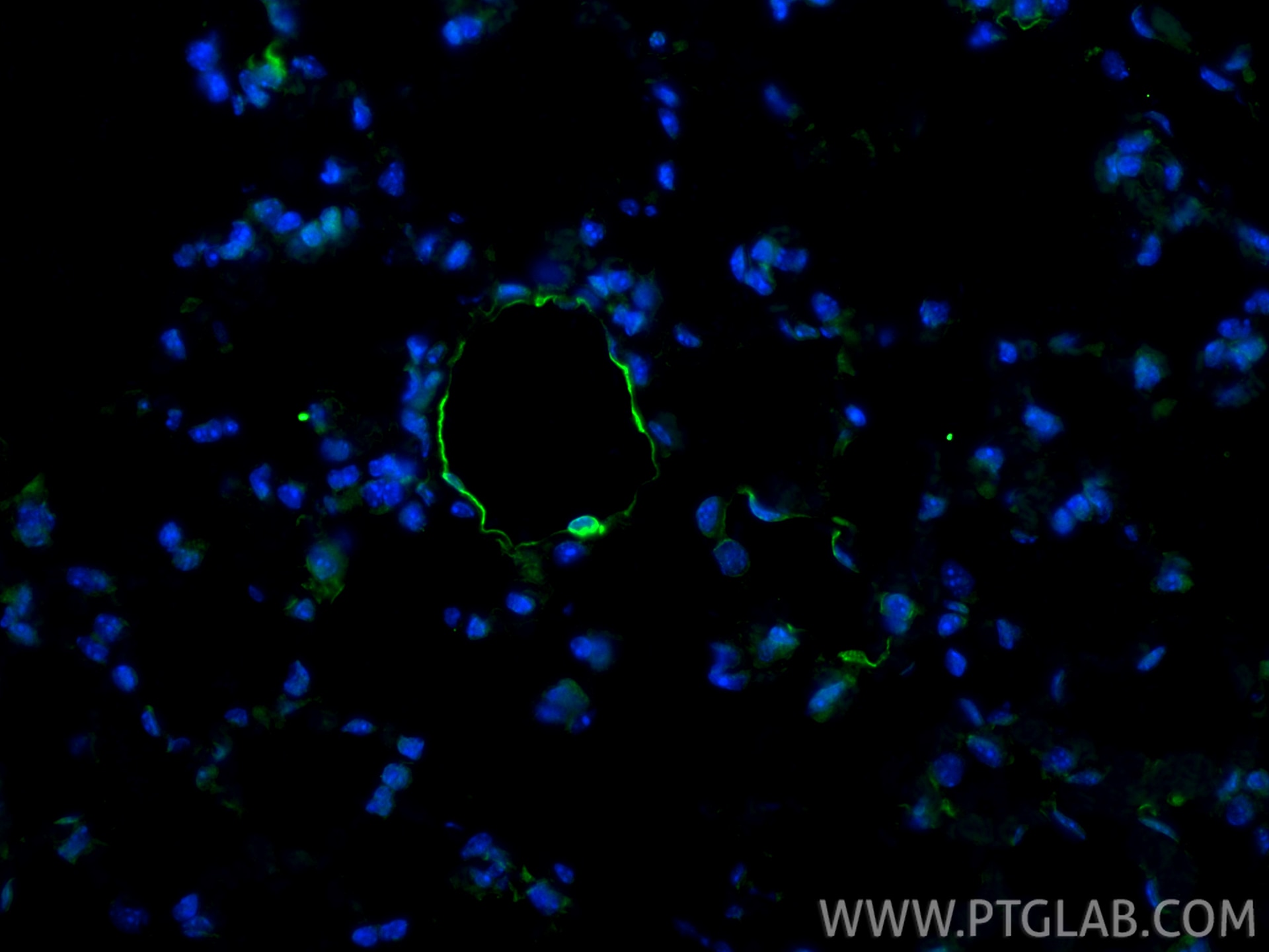 Immunofluorescence (IF) / fluorescent staining of mouse lung tissue using EMCN Polyclonal antibody (34333-1-AP)