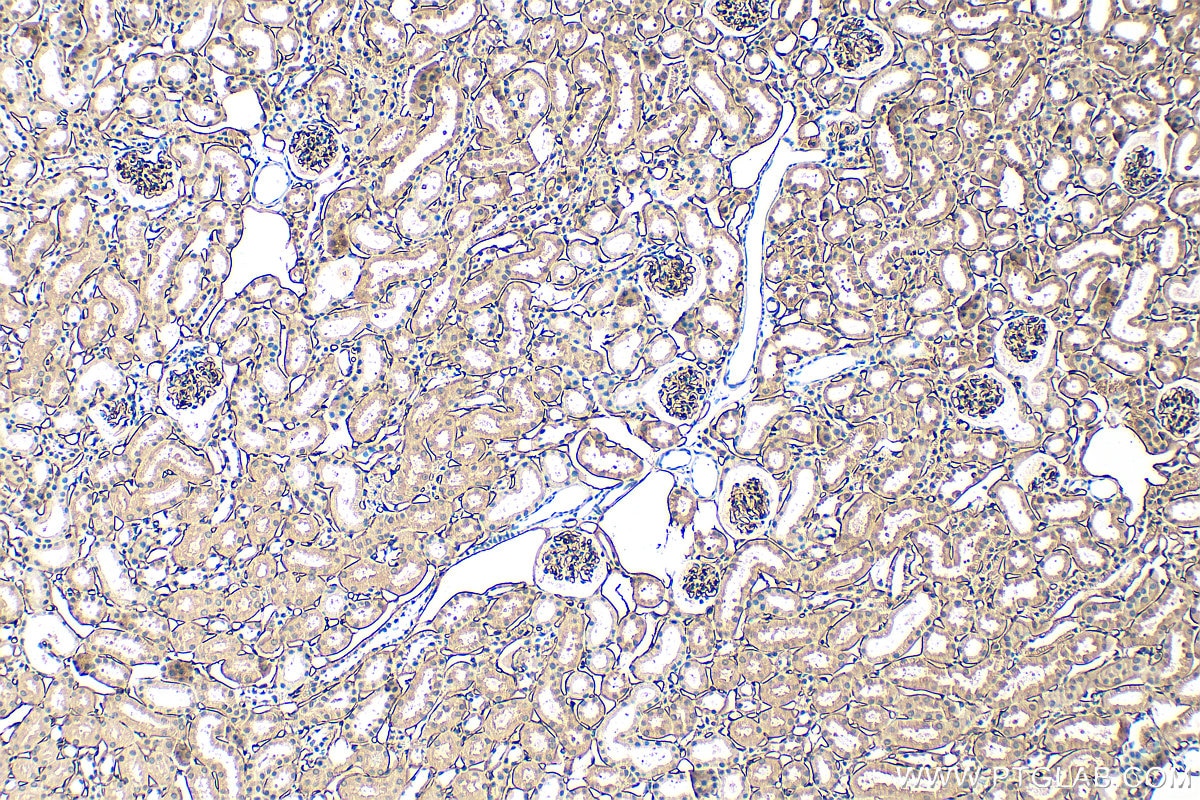 Immunohistochemistry (IHC) staining of mouse kidney tissue using EMCN Polyclonal antibody (34333-1-AP)