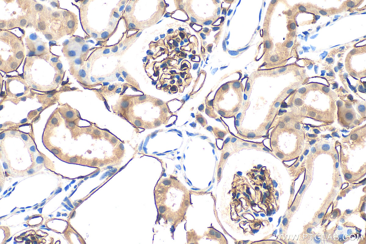 Immunohistochemistry (IHC) staining of mouse kidney tissue using EMCN Polyclonal antibody (34333-1-AP)