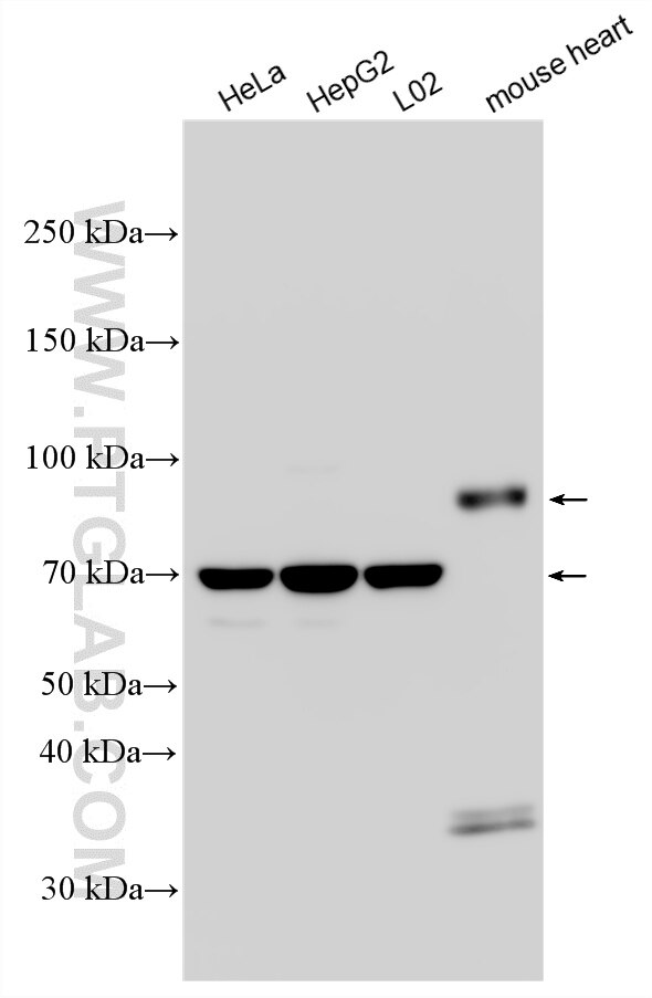 Western Blot (WB) analysis of various lysates using EMCN Polyclonal antibody (34333-1-AP)