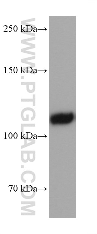 Western Blot (WB) analysis of HUVEC cells using EMCN Monoclonal antibody (67854-1-Ig)