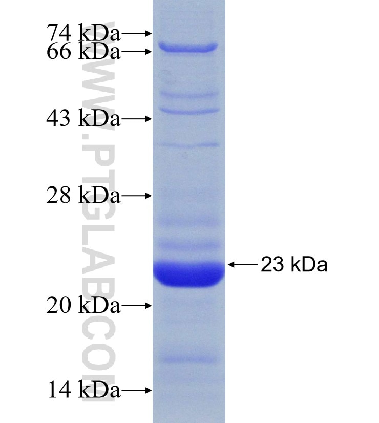EMCN fusion protein Ag31146 SDS-PAGE