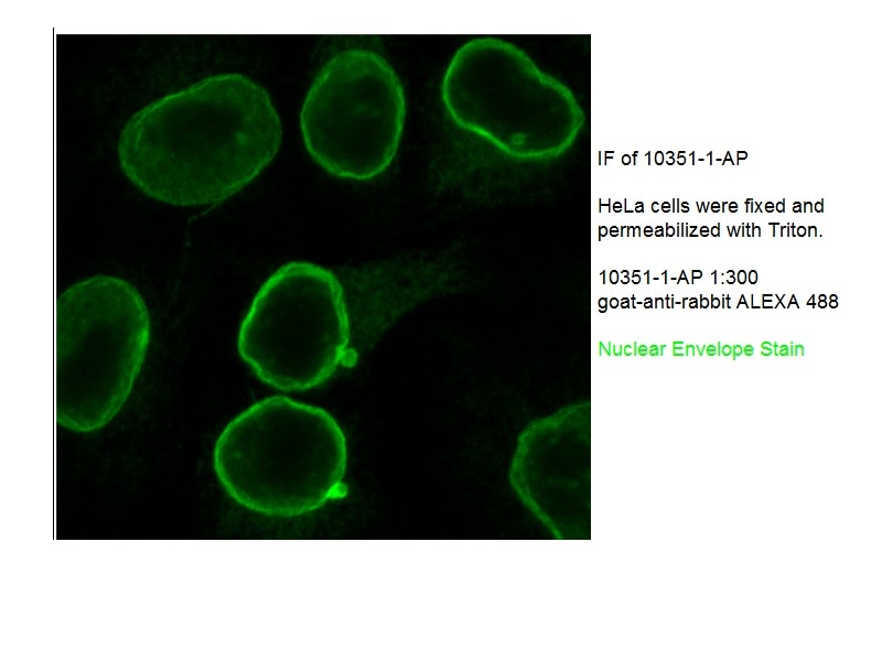 Immunofluorescence (IF) / fluorescent staining of HeLa cells using Emerin Polyclonal antibody (10351-1-AP)
