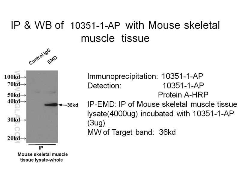 Immunoprecipitation (IP) experiment of mouse skeletal muscle tissue using Emerin Polyclonal antibody (10351-1-AP)