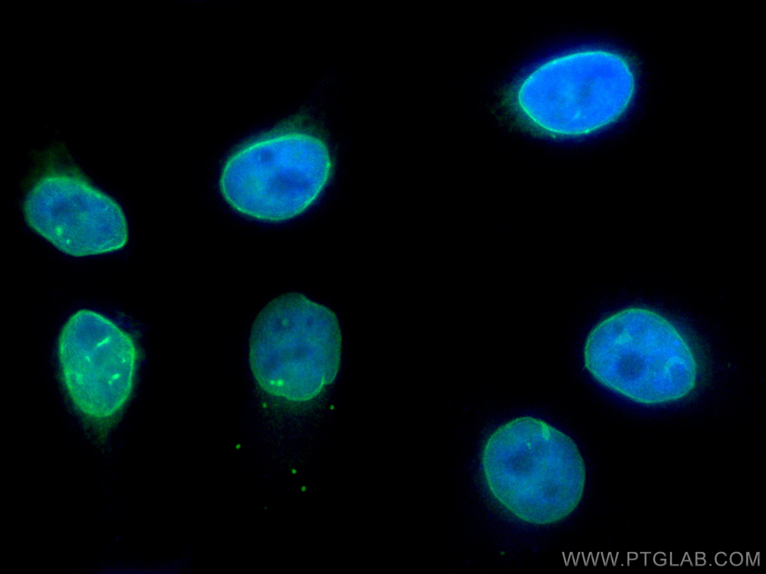 Immunofluorescence (IF) / fluorescent staining of HeLa cells using Emerin Polyclonal antibody (10351-1-AP)
