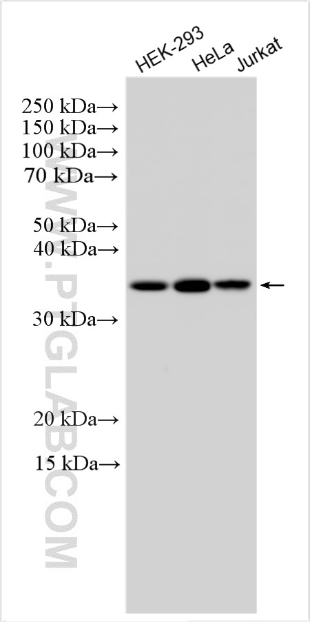 Western Blot (WB) analysis of various lysates using Emerin Polyclonal antibody (10351-1-AP)