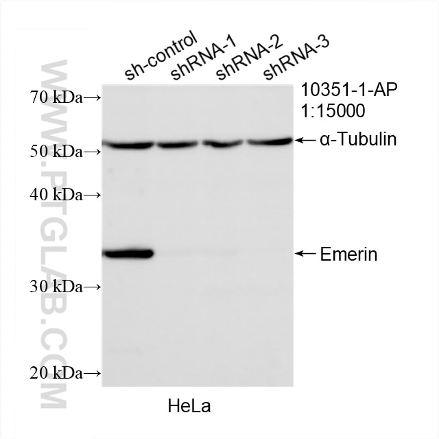 Western Blot (WB) analysis of HeLa cells using Emerin Polyclonal antibody (10351-1-AP)