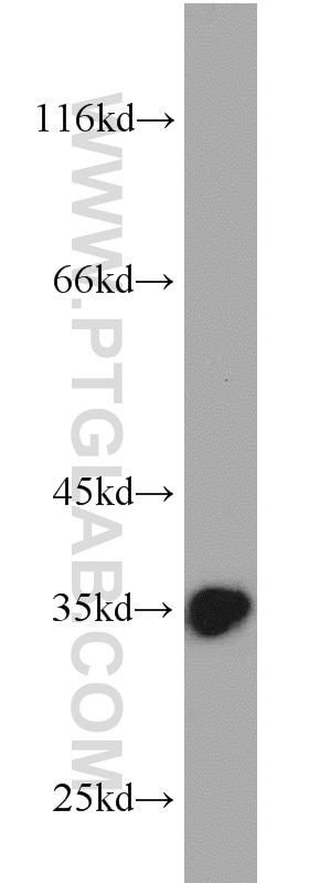 Western Blot (WB) analysis of HepG2 cells using Emerin Polyclonal antibody (10351-1-AP)