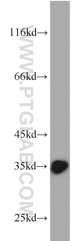 Western Blot (WB) analysis of HepG2 cells using Emerin Polyclonal antibody (10351-1-AP)