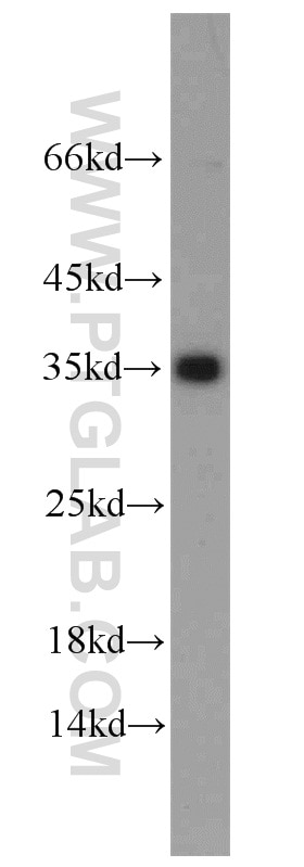 Western Blot (WB) analysis of HeLa cells using Emerin Polyclonal antibody (10351-1-AP)