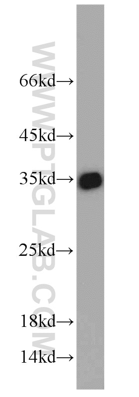 Western Blot (WB) analysis of MCF-7 cells using Emerin Polyclonal antibody (10351-1-AP)