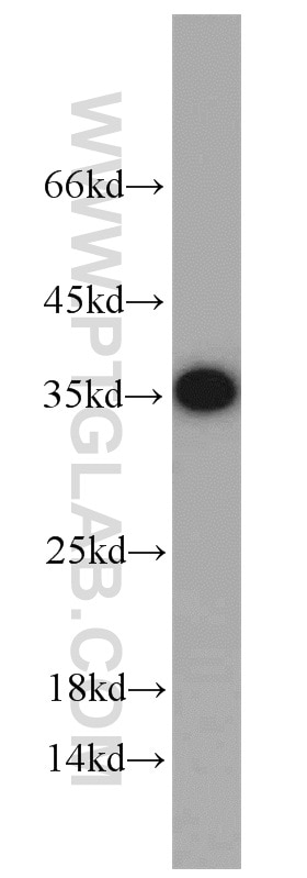 Western Blot (WB) analysis of HEK-293 cells using Emerin Polyclonal antibody (10351-1-AP)