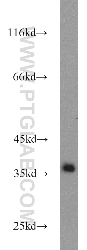 Western Blot (WB) analysis of COLO 320 cells using Emerin Polyclonal antibody (10351-1-AP)