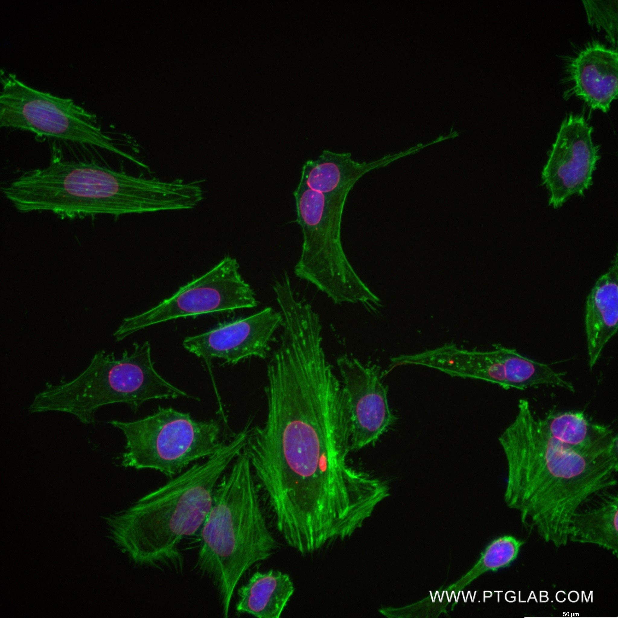 Immunofluorescence (IF) / fluorescent staining of HeLa cells using EMD Recombinant antibody (82888-1-RR)