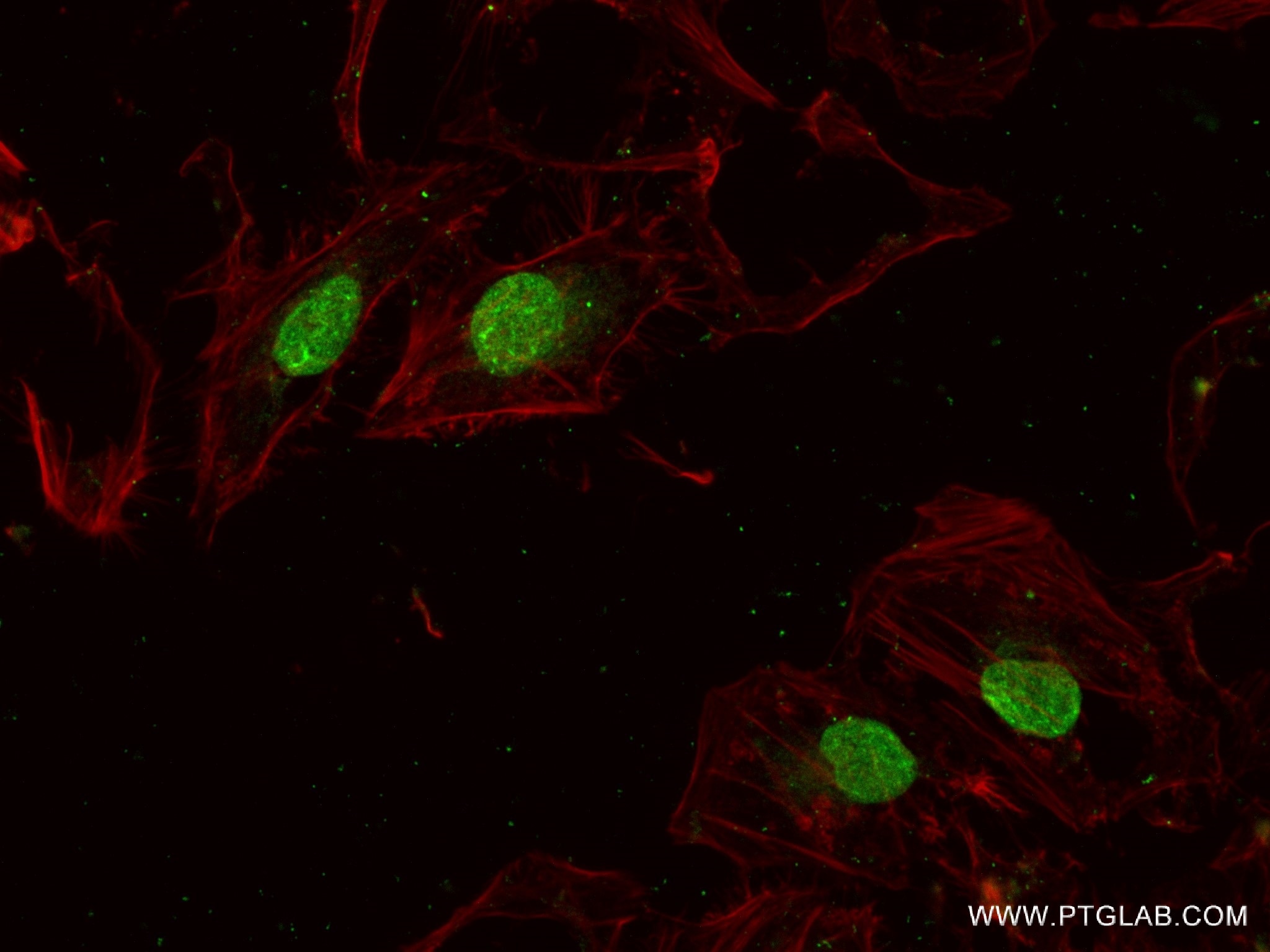 Immunofluorescence (IF) / fluorescent staining of HeLa cells using EMD Recombinant antibody (82888-2-RR)