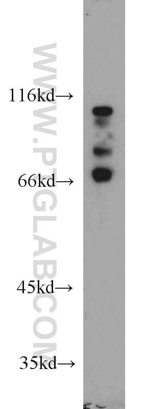 Western Blot (WB) analysis of human liver tissue using EME1 Polyclonal antibody (12975-1-AP)