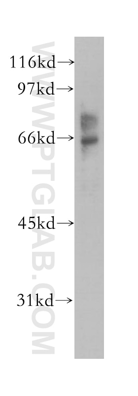 Western Blot (WB) analysis of A375 cells using EME1 Polyclonal antibody (12975-1-AP)