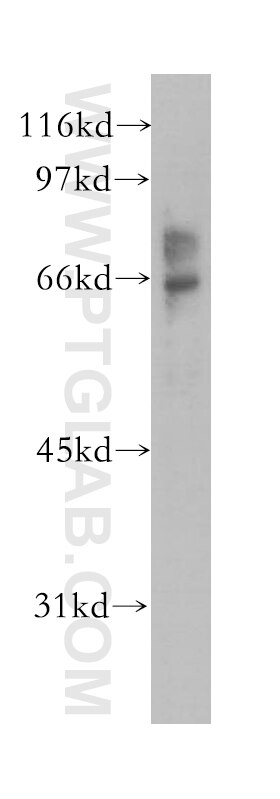 Western Blot (WB) analysis of A375 cells using EME1 Polyclonal antibody (12975-1-AP)