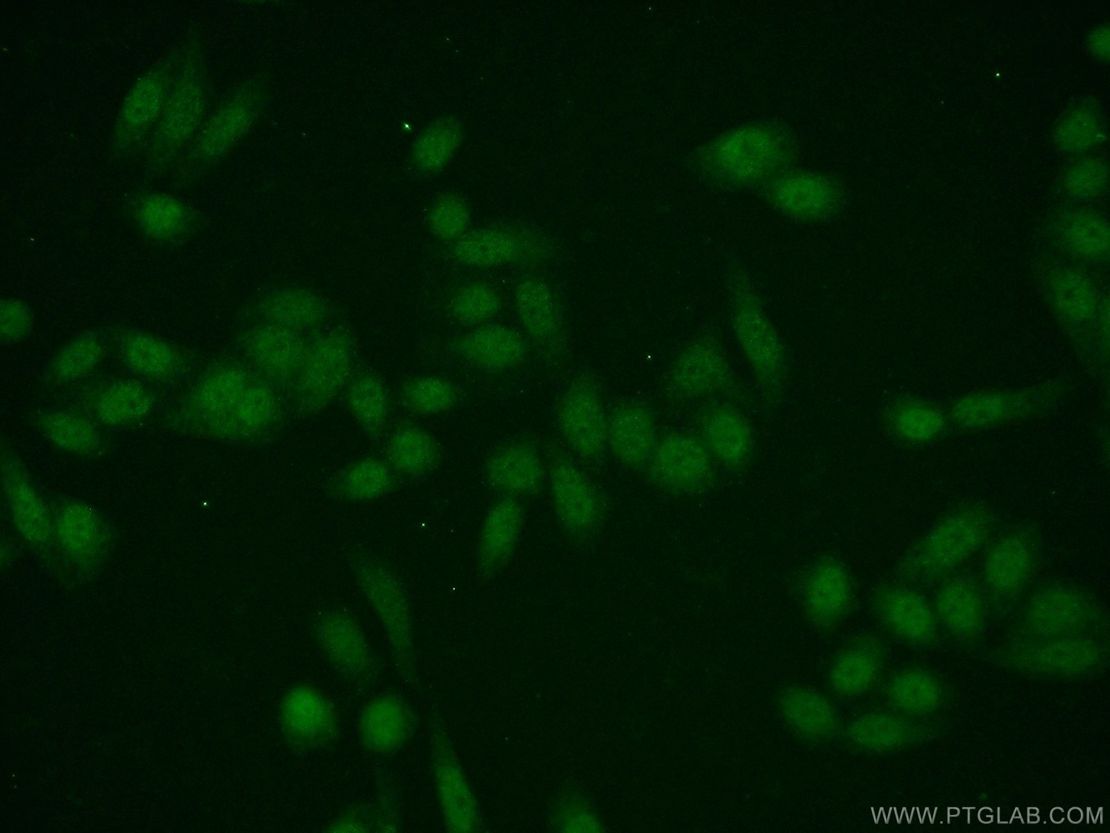 Immunofluorescence (IF) / fluorescent staining of HeLa cells using EMG1 Polyclonal antibody (11965-1-AP)