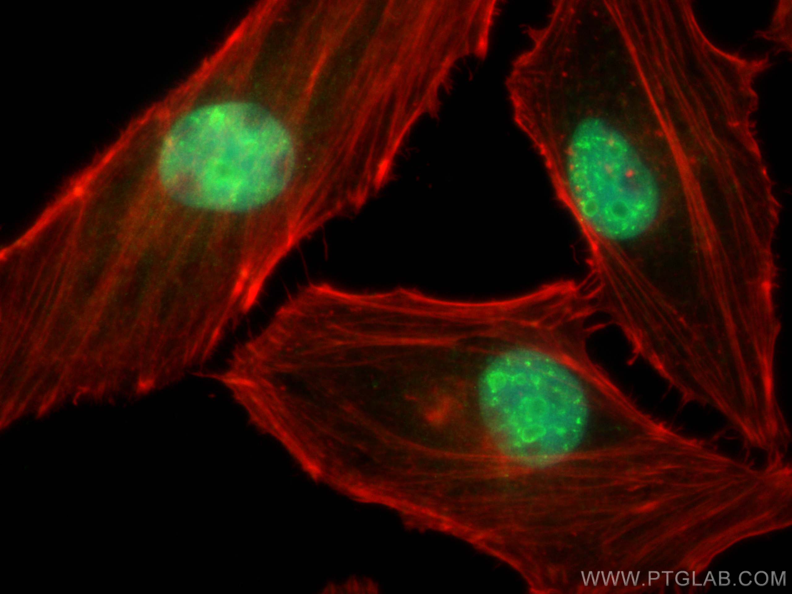 Immunofluorescence (IF) / fluorescent staining of HeLa cells using EMG1 Polyclonal antibody (11965-1-AP)