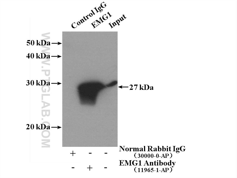Immunoprecipitation (IP) experiment of HeLa cells using EMG1 Polyclonal antibody (11965-1-AP)