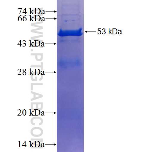 EMG1 fusion protein Ag2575 SDS-PAGE