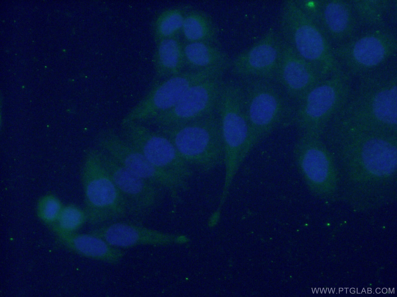 Immunofluorescence (IF) / fluorescent staining of HeLa cells using EMILIN1 Polyclonal antibody (10643-1-AP)