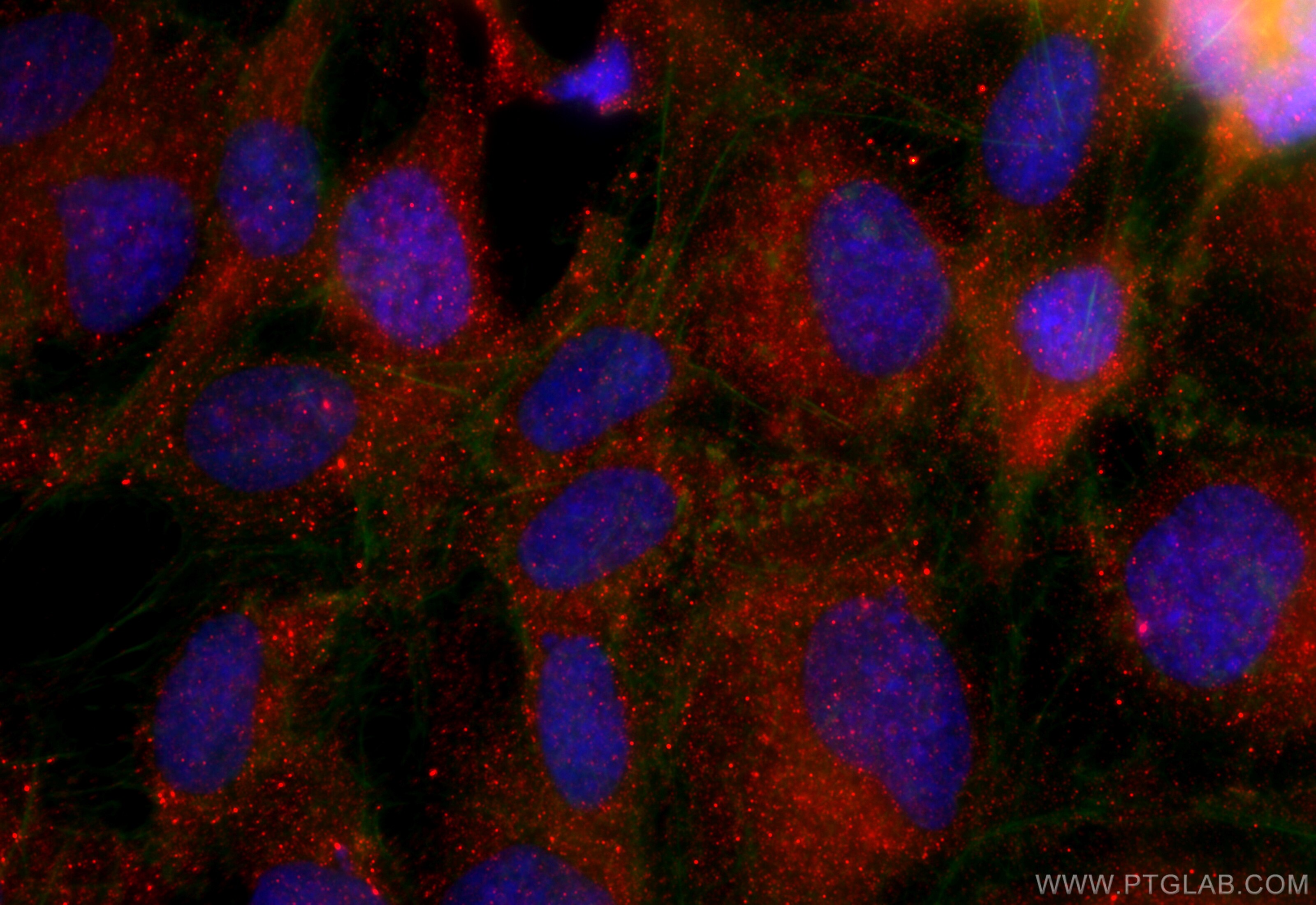 Immunofluorescence (IF) / fluorescent staining of SKOV-3 cells using EMILIN1 Polyclonal antibody (10643-1-AP)