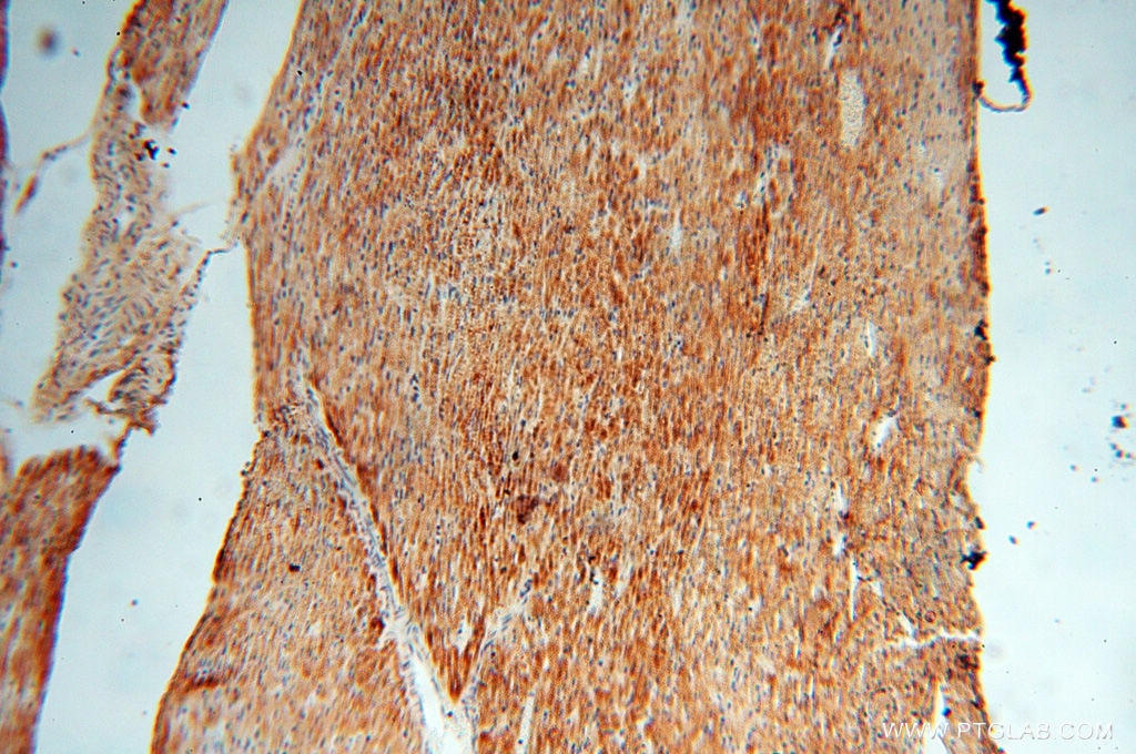 IHC staining of human heart using 10643-1-AP