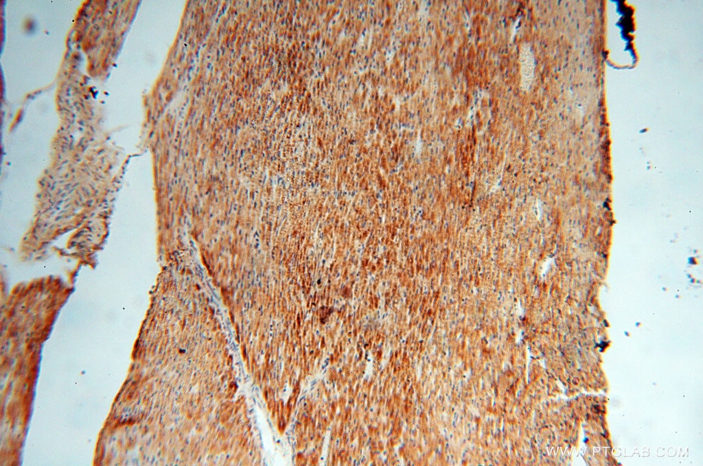 Immunohistochemistry (IHC) staining of human heart tissue using EMILIN1 Polyclonal antibody (10643-1-AP)