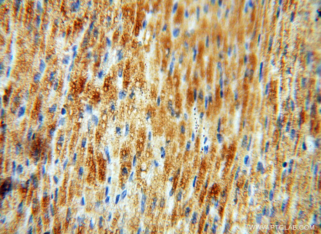 Immunohistochemistry (IHC) staining of human heart tissue using EMILIN1 Polyclonal antibody (10643-1-AP)