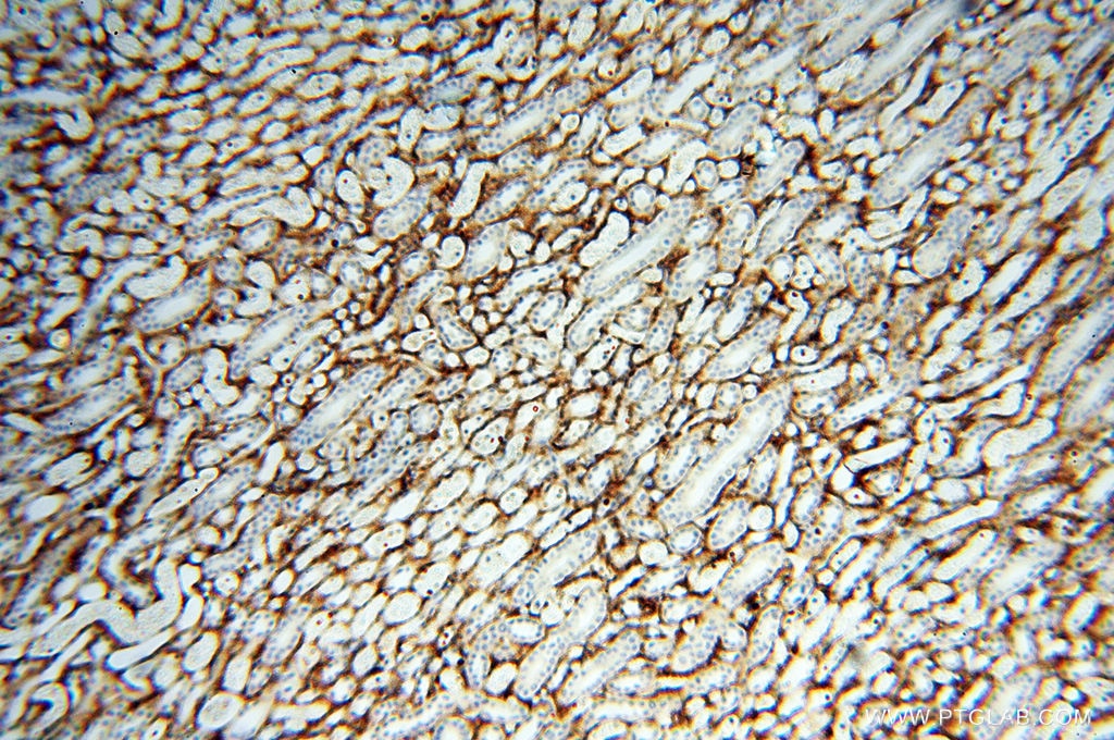 Immunohistochemistry (IHC) staining of human kidney tissue using EMILIN1 Polyclonal antibody (10643-1-AP)