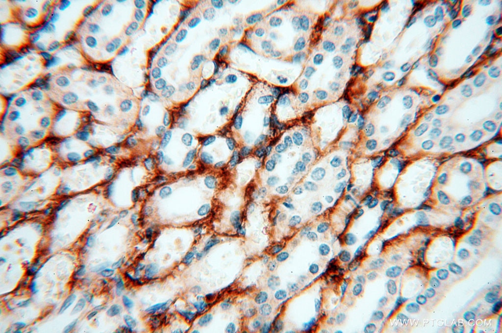 Immunohistochemistry (IHC) staining of human kidney tissue using EMILIN1 Polyclonal antibody (10643-1-AP)